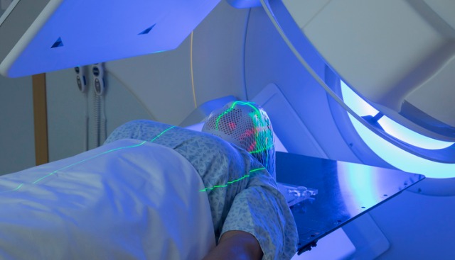Woman undergoing radiation therapy for meningioma