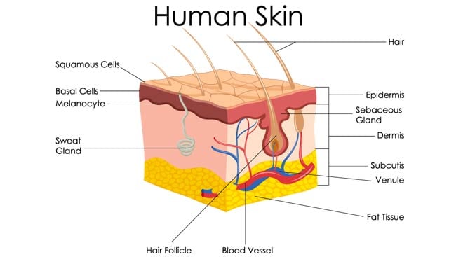 Basal Cell Carcinoma diagram showing layers of skin starting with epidermus