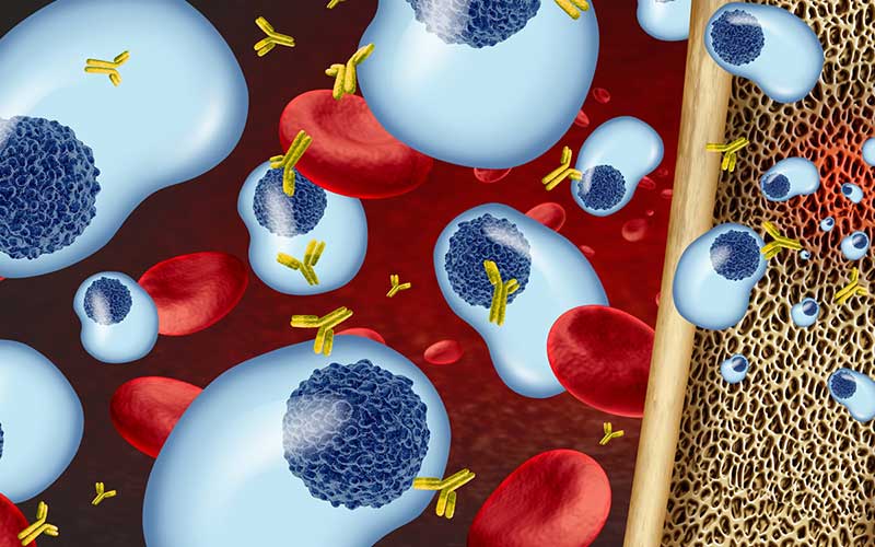 Multiple Myeloma cells