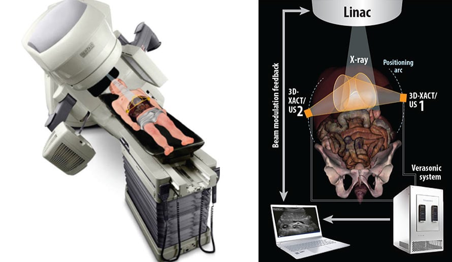 Radiation Acoustics Linac Machine graphic