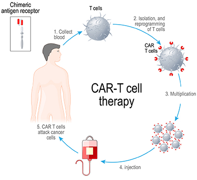 Graphic of the CAR T process