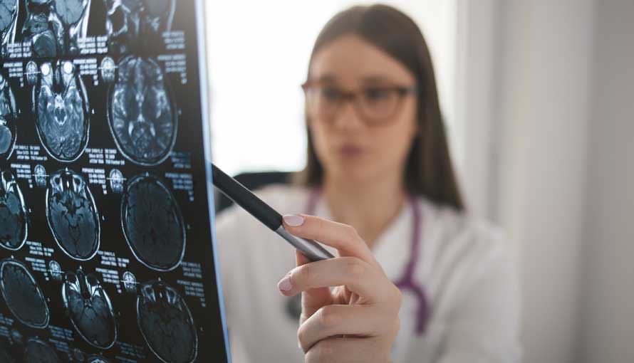 A doctor looking a MRI brain scan