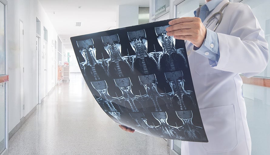 A doctor reviews head x-rays