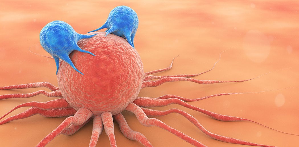 melanoma tumor under microscope