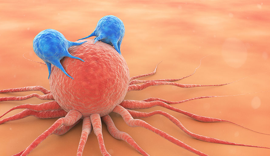 melanoma tumor shown under the microscope