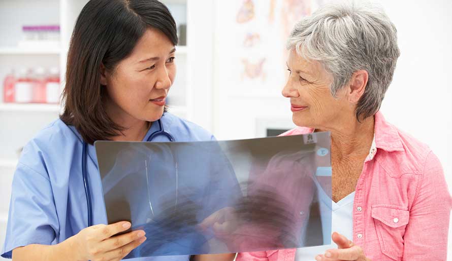 Doctor discussing stages of lung cancer with patient