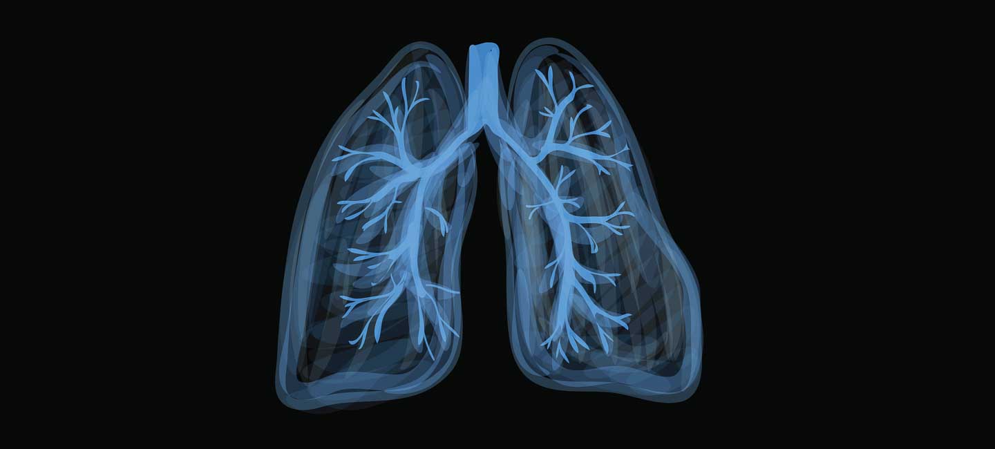 Illustration of lungs with blue highlights on black background