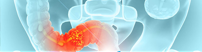Identifying Accelerated Biological Age in Young Colorectal Cancer Patients Could Improve Post-Treatment Care