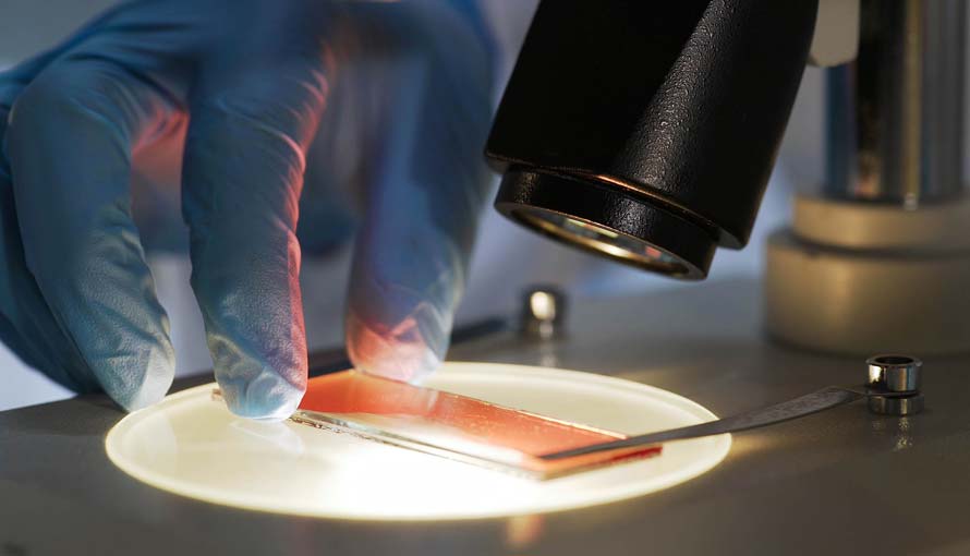 a blood sample being exaimed