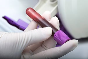 Blood taken during a blood test