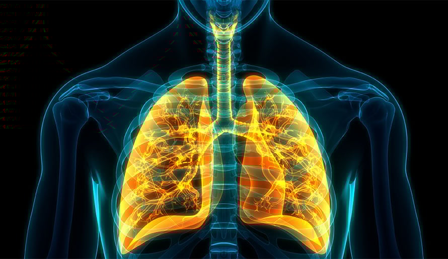 3-D image of lung