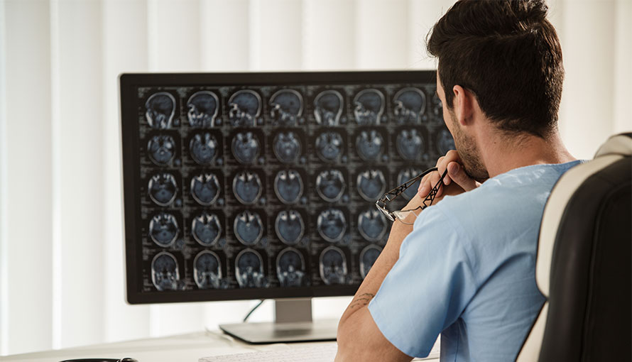 Physician looking a skull base scans