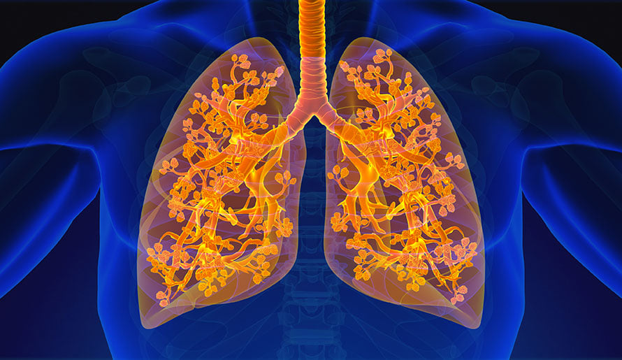 lung cancer lit up on scan