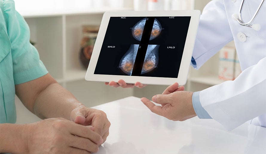 Doctor showing mammogram scans