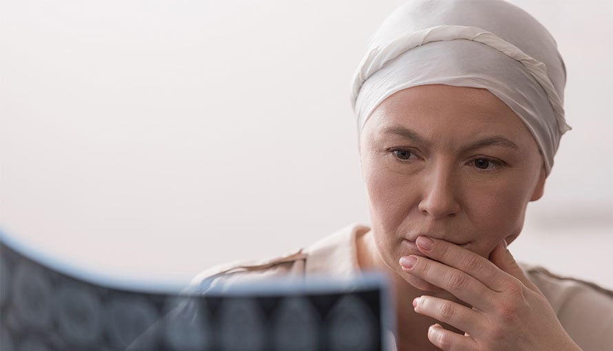 Woman looking at colon cancer scans