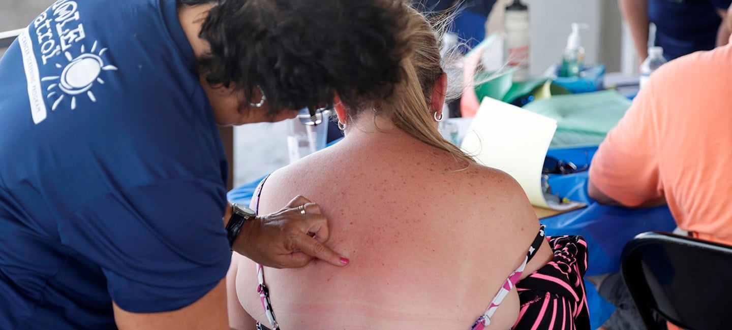 person receiving a skin cancer check