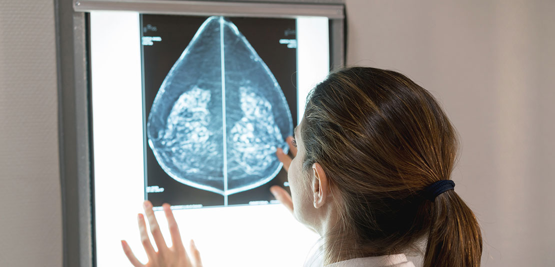 radiologist looking a breast images