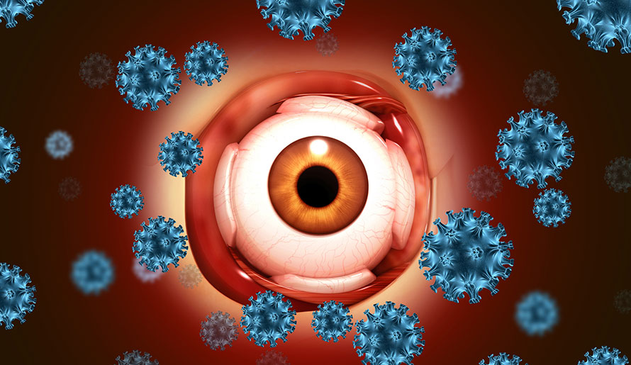 eye showing ocular lymphoma