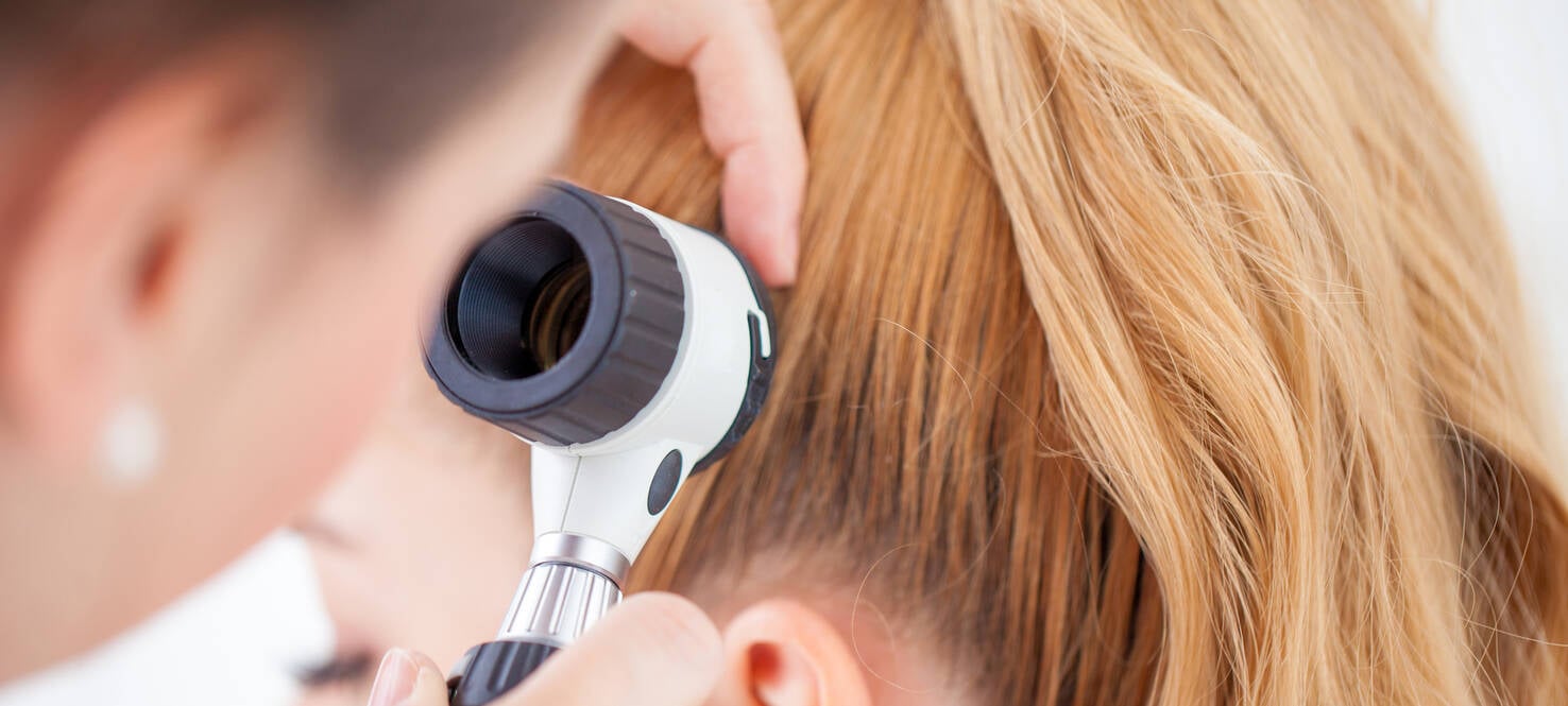 doctor examining scalp for melanoma
