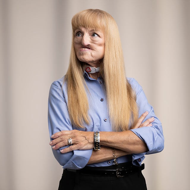 Profile headshot of Zoe, head and neck cancer and kidney cancer survivor. 