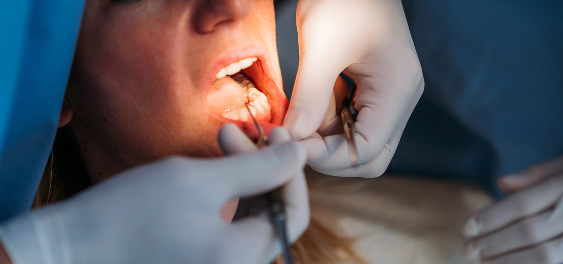 image of a dentist doing a dental exam on someone